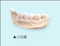 オールセラミック・前歯＆小臼歯