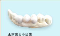 メタルセラミック・前歯＆小臼歯